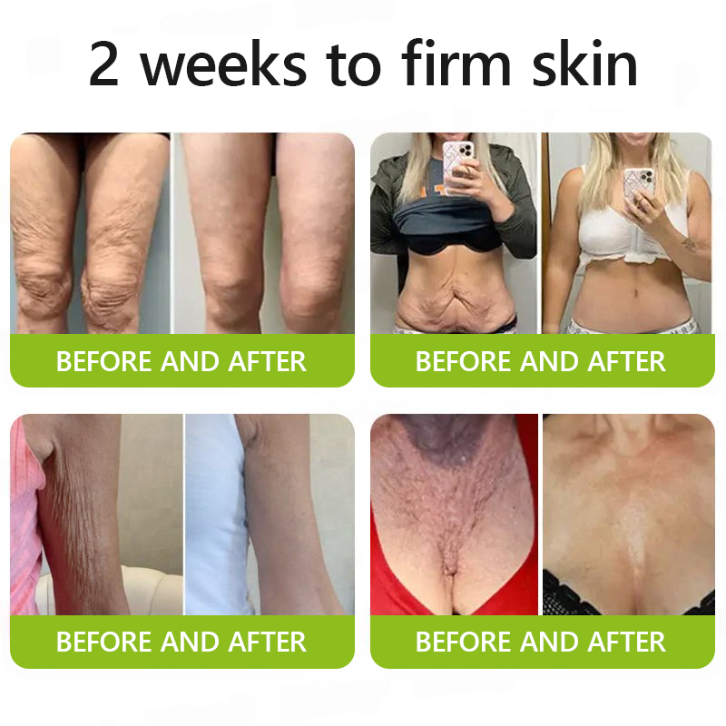 ReviRadiance™ — Unlock Youthful Lift and Radiance Without Needles or Waiting