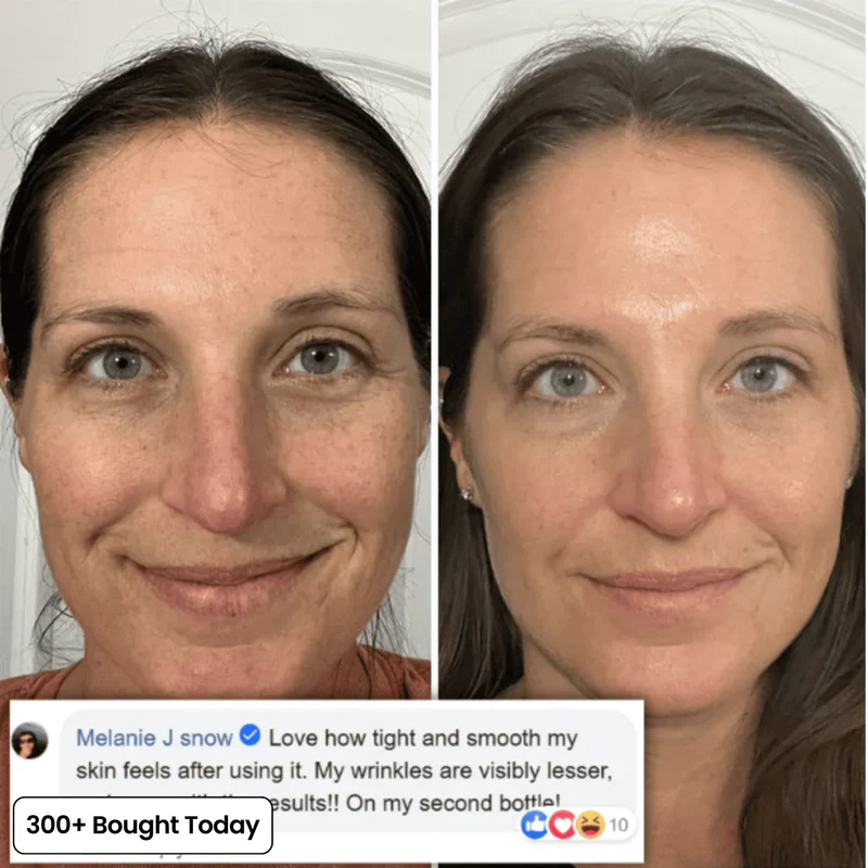 Her+ Calcium™ — Swipe Away Wrinkles, Smile Lines & Tired Under-Eyes In Seconds