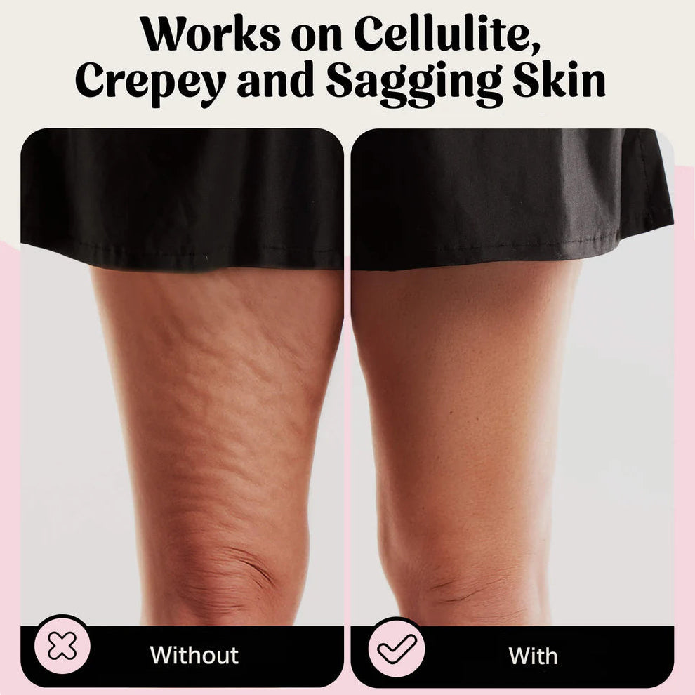 ViveLisse™ Body Tape — Instantly Smooth, Lift, and Sculpt Your Confidence in Seconds