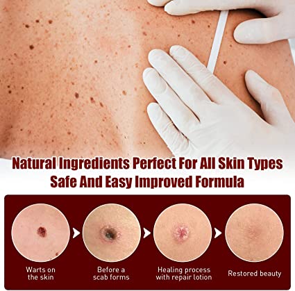 DermaVanish™ — Effortless, Pain-Free Skin Renewal That Restores Your Confidence Fast
