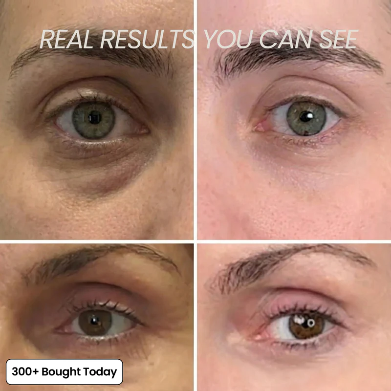 Her+ Calcium™ — Swipe Away Wrinkles, Smile Lines & Tired Under-Eyes In Seconds