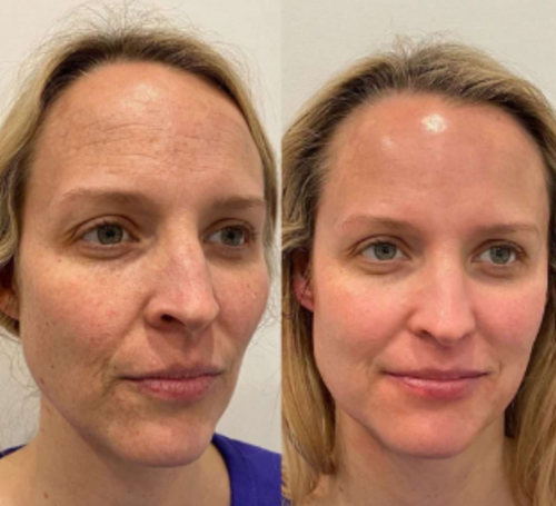 RejuviSkin™ — Unleash Radiant, Youthful Glow That Turns Heads Instantly