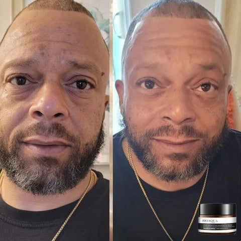 LumaFleur™ — Reveal Brighter, Youthful Eyes That Captivate Instantly