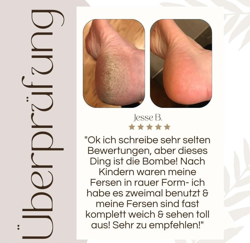 SoleRadiance™ — Unlock Baby-Soft Feet You’ll Proudly Show Off Every Day