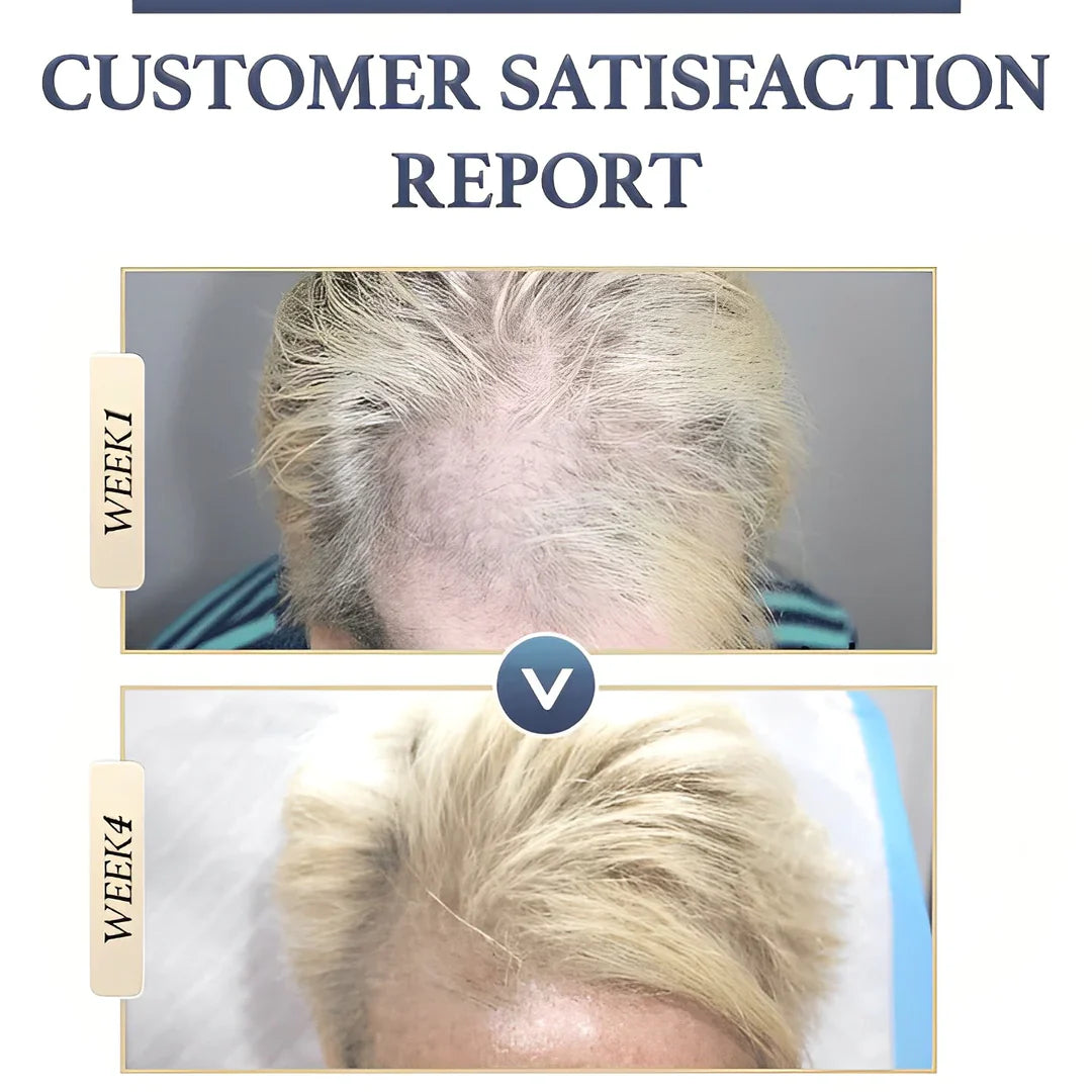 1+1 FREE | RiceGlow™ - Anti-Hair Loss (Last Day Discount)