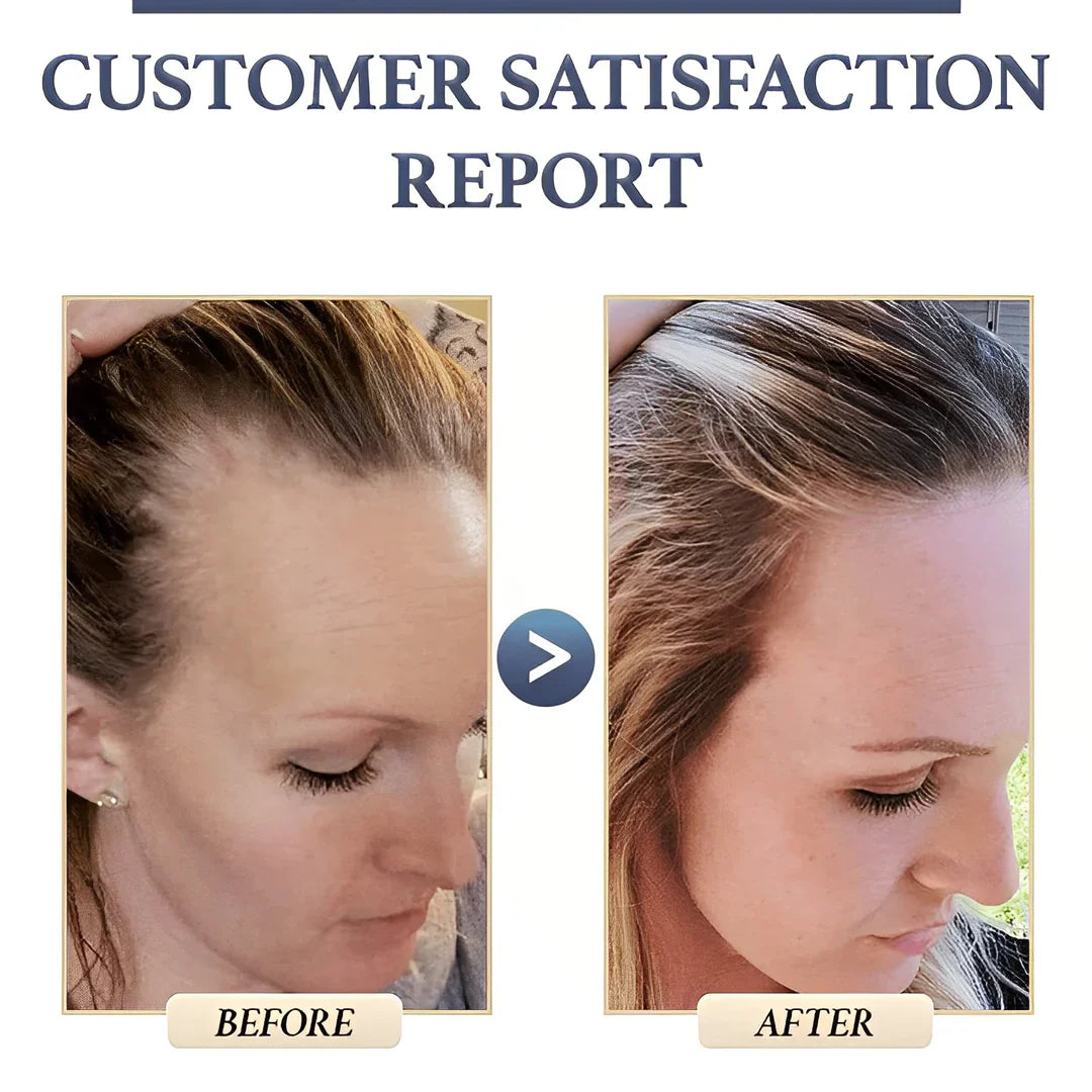 1+1 FREE | RiceGlow™ - Anti-Hair Loss (Last Day Discount)