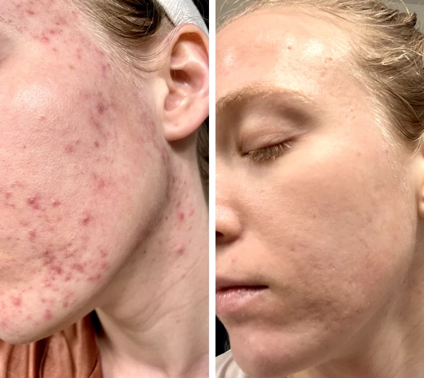 Transform Dull Skin into Radiant Freshness and Gentle Relaxation