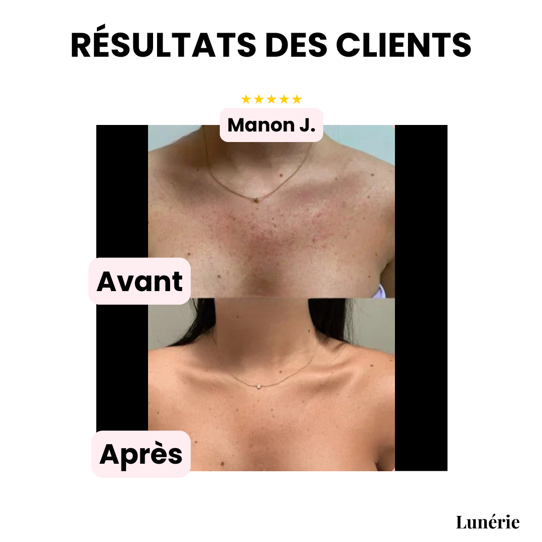 RamaraCover™ — Unleash Your True Glow with All-Day Flawless Confidence