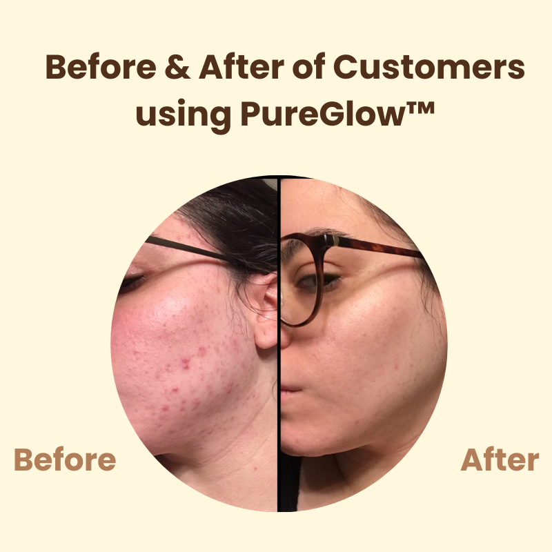 Last Day 50% OFF🔥 | PureGlow™ Black Tea Mask