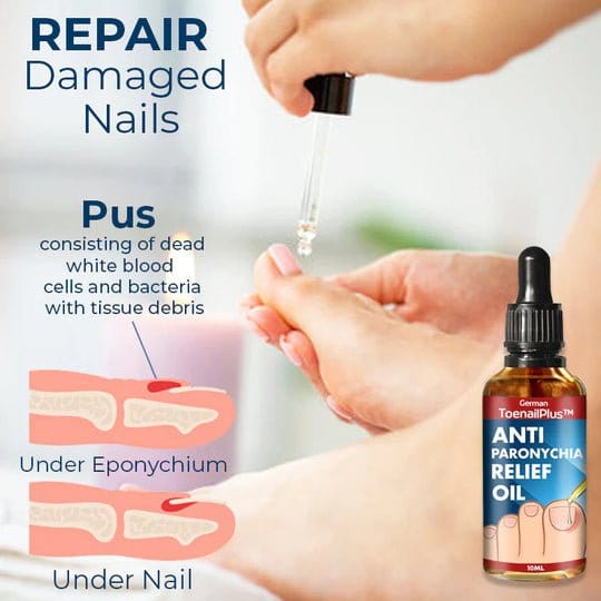 ToenailPlus™ Anti-Paronychia Relief Oil
