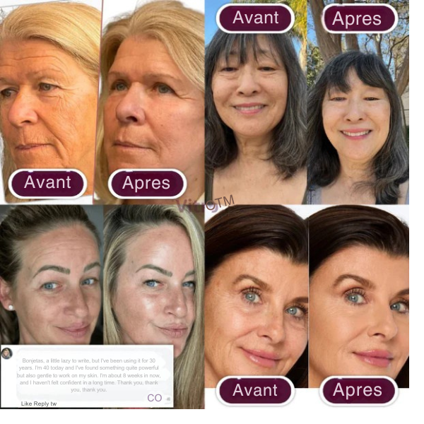 RadiantMorph™ — Unlock Youthful Glow and Firmness in Just 10 Seconds a Day