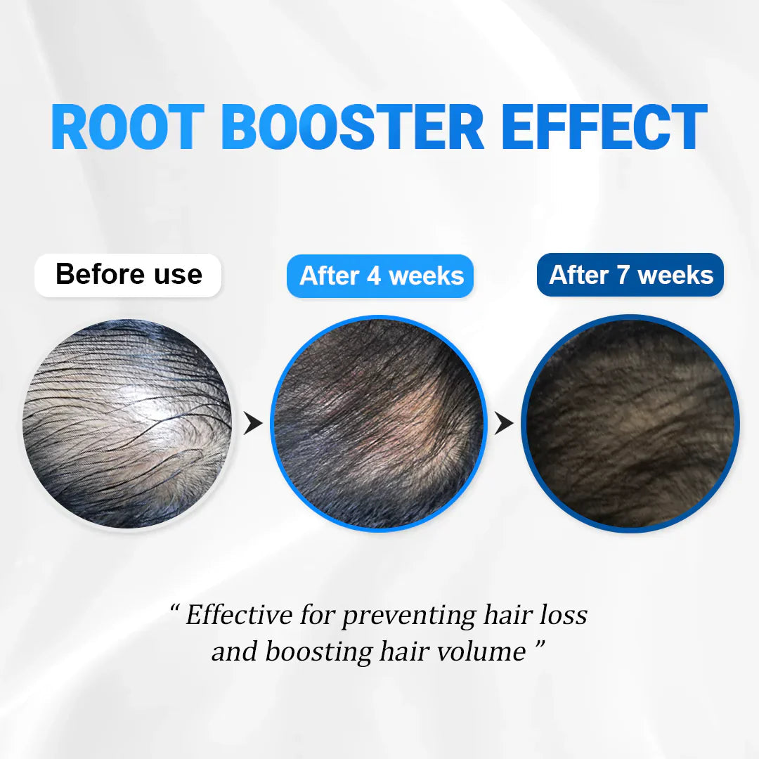 RevitaRoot™ — Wake Up to Thicker, Stronger Hair You Can Feel Every Day