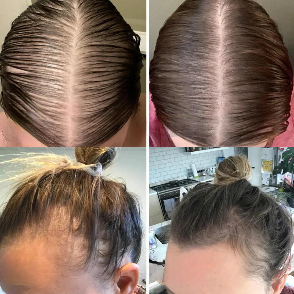 Arvilaro: Your natural oil for hair growth