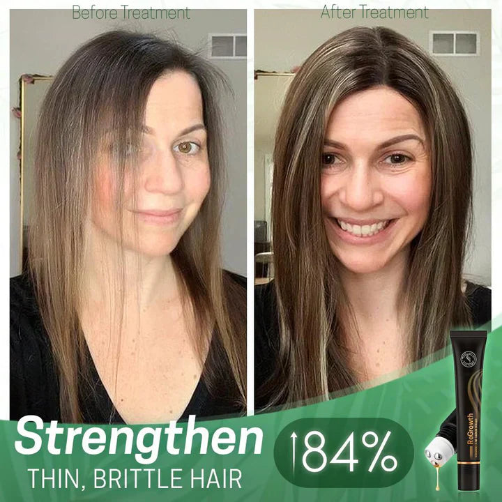 ViraCrest™ — Transform Your Thinning Hair Into a Lush, Head-Turning Crown
