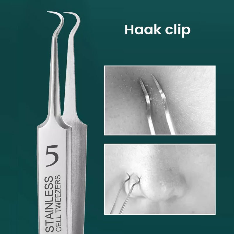 GlideSkin™ — Unleash Your Glow with Painless, Precision Blackhead Removal