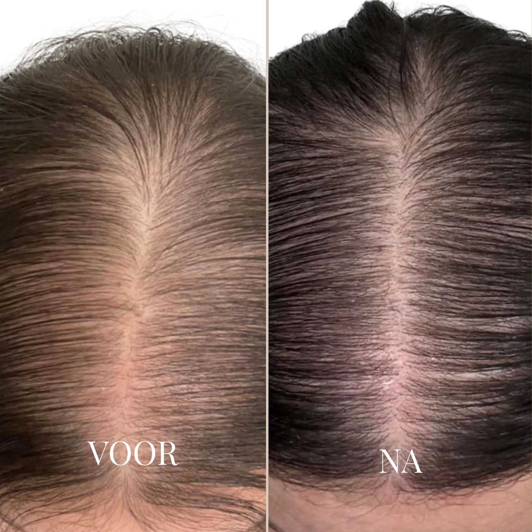 GlamMist™ — Flaunt Vibrant, Root-Perfect Hair Anytime, Anywhere