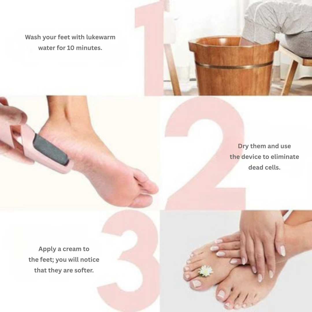 VelveteEase™ — Transform Rough, Cracked Feet into Irresistible Softness You’ll Love to Show Off