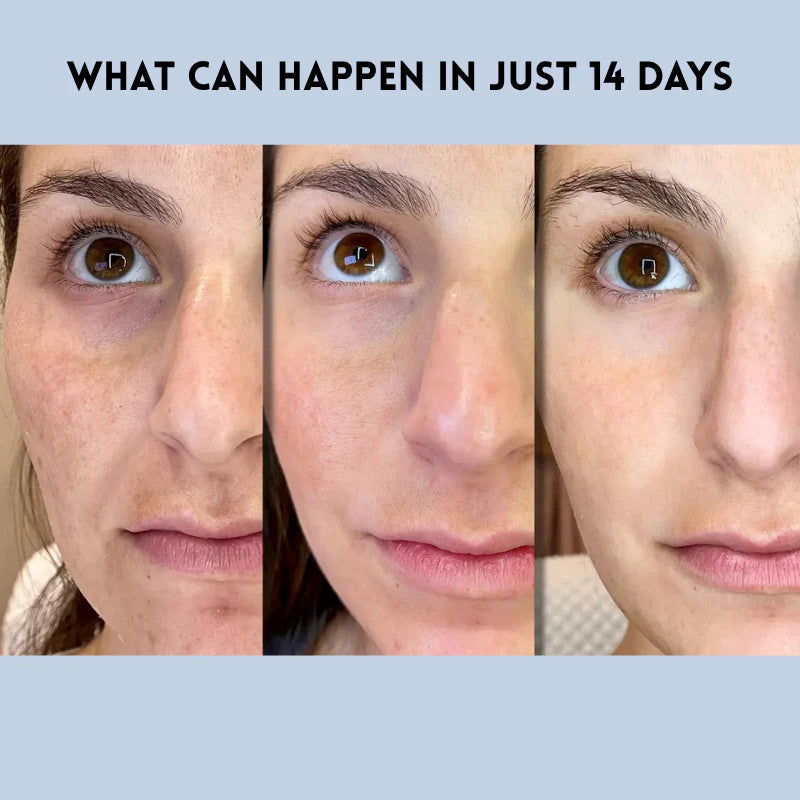 LumaLift™ — Instantly Rewind Time with a Youthful, Radiant Glow