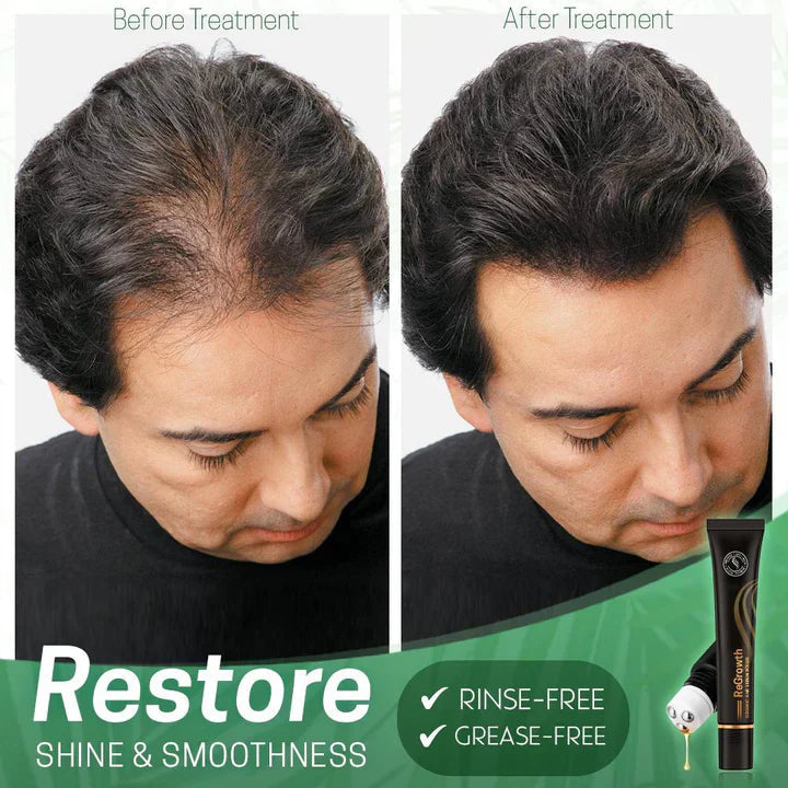 ViraCrest™ — Transform Your Thinning Hair Into a Lush, Head-Turning Crown