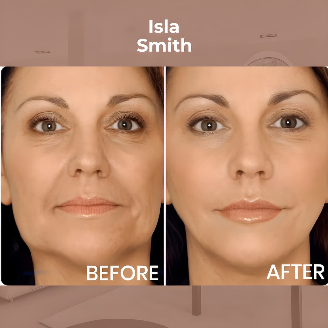 VivaLift™ — Instantly Lift and Reveal Your Most Radiant, Youthful Glow Without a Trace