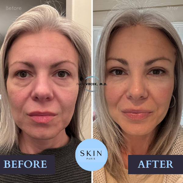 GloraLift™ — Reveal Radiant, Youthful Skin That Turns Heads Every Day