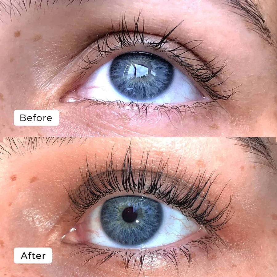 LashAura™ — Wake Up to Naturally Bold, Head-Turning Lashes in Just One Week