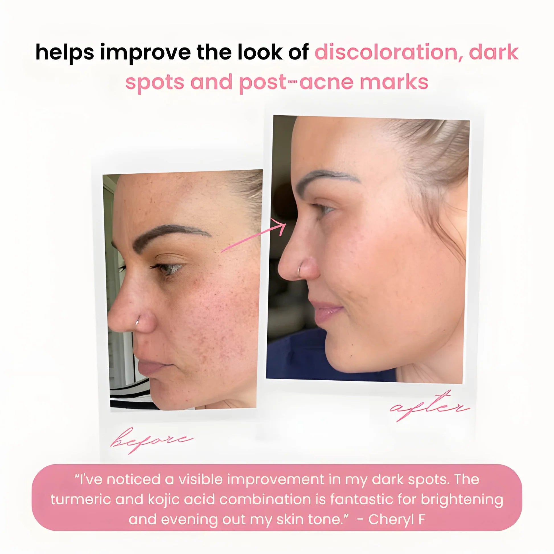 GlowNexa™ — Unleash Your Radiant, Spot-Free Glow Instantly