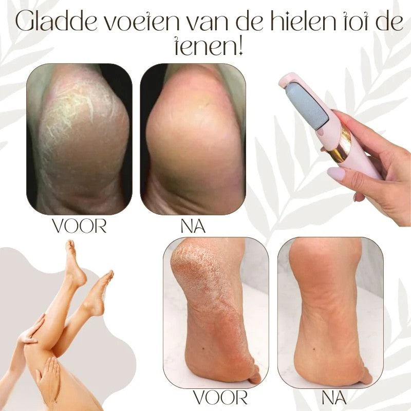 SilkStride™ — Effortless Soft Feet That Boost Your Confidence Instantly