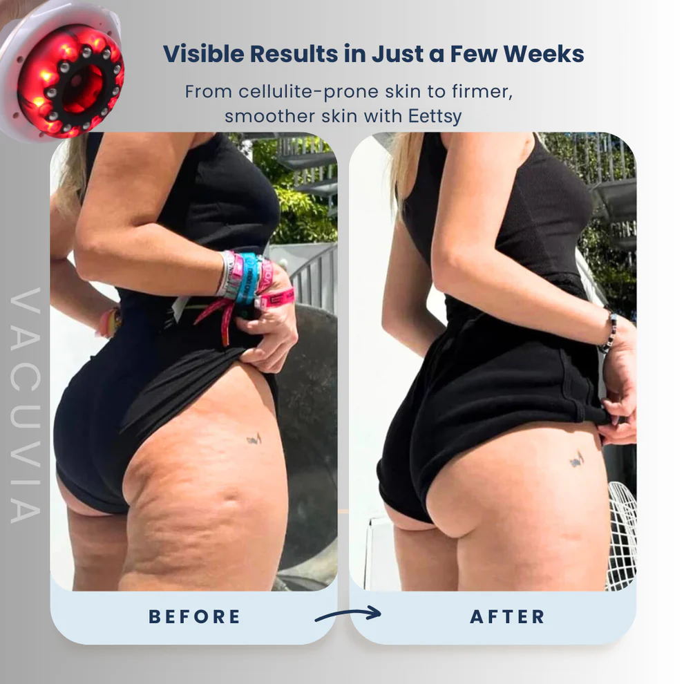 Sculptora™ — Reveal Firm, Silky Skin That Boosts Your Confidence Every Day