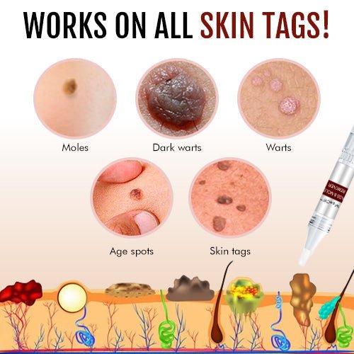 DermaVanish™ — Effortless, Pain-Free Skin Renewal That Restores Your Confidence Fast