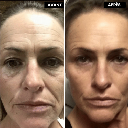 VitaFirm™ Duo — Unlock Firm, Radiant Skin That Turns Back Time