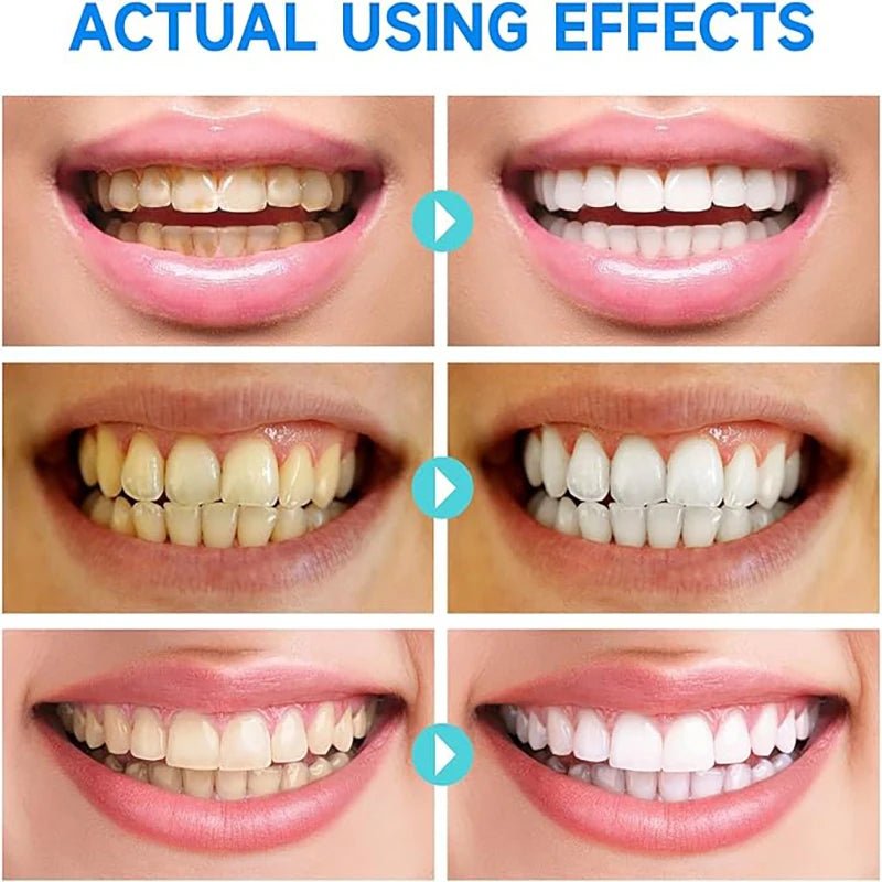 LumaShield™ — Reveal a Brilliant Smile That Heals and Refreshes Instantly