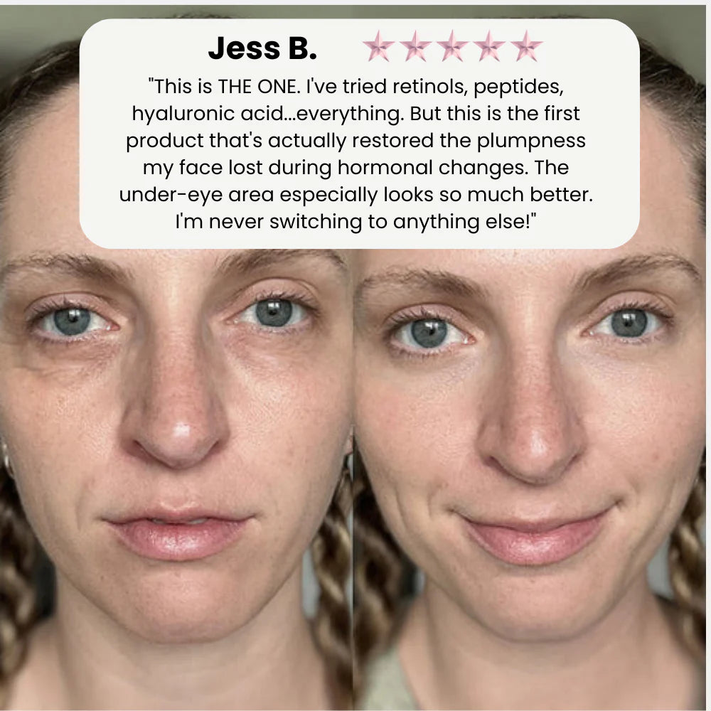 VivaDerm™ — Instantly Lift and Radiate Confidence with Youthful, Plump Skin