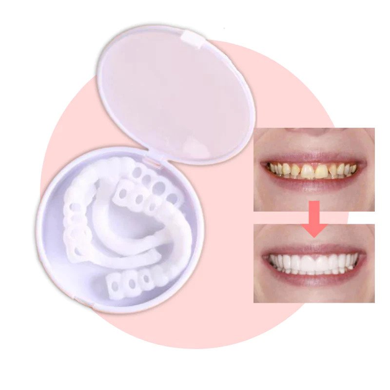 Snap-on Teeth - With these veneers, always have the perfect smile.