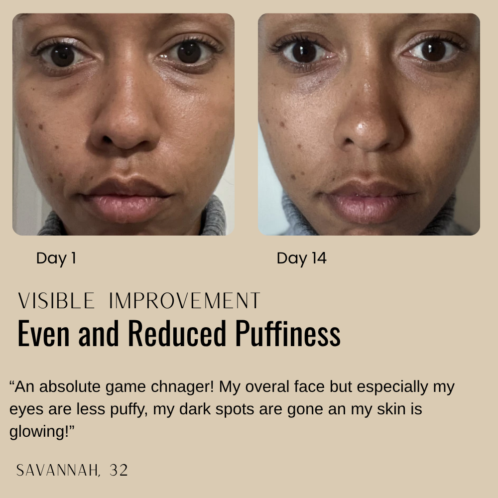 Nature's Fix™ - Peptide Neck & Chest Tightening Cream