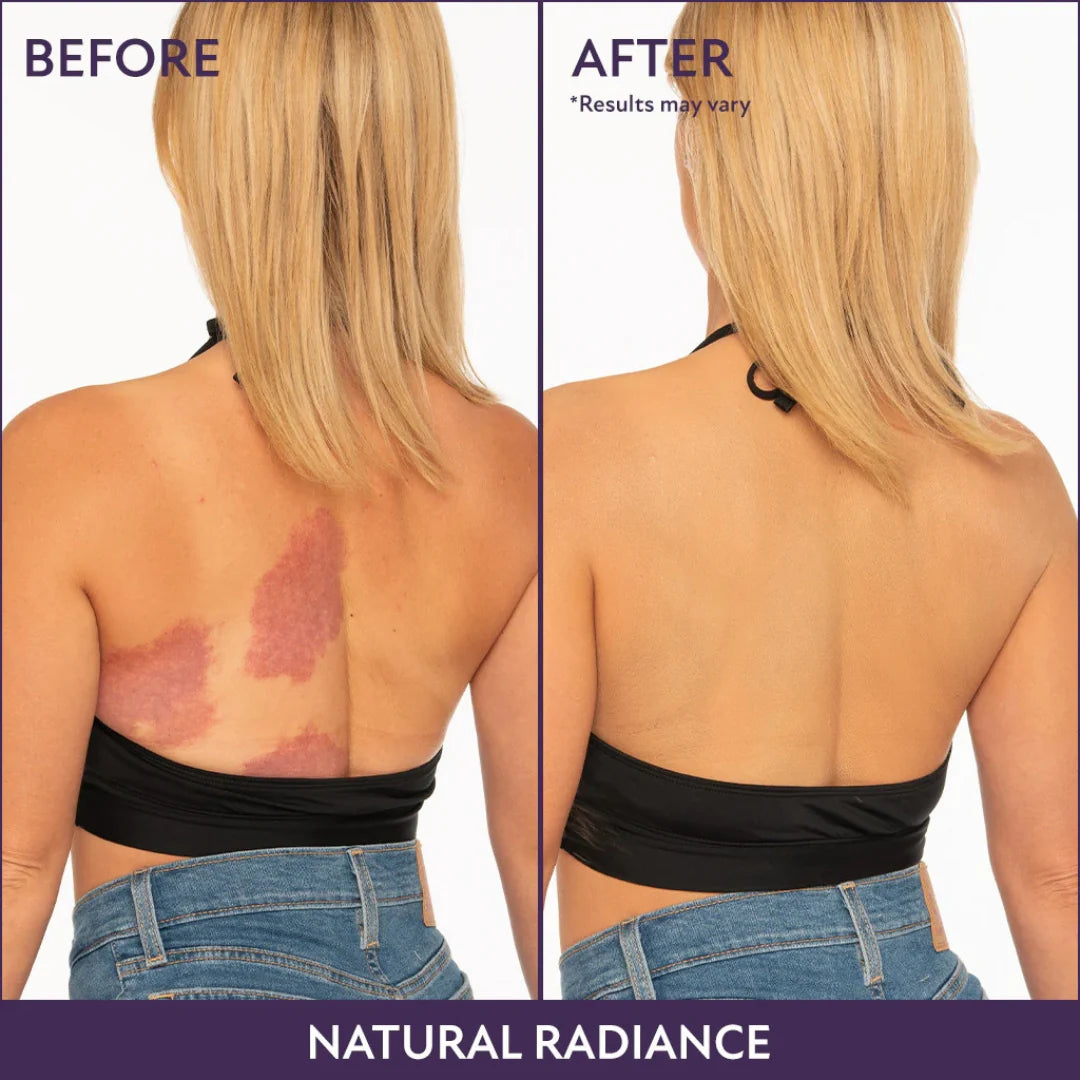 RadiantVeil™ — Instantly Reveal Smooth, Flawless Skin That Feels Like You