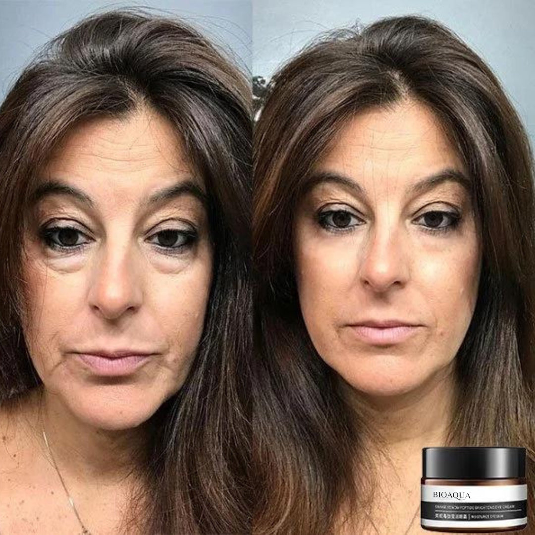 RamoraRadiance™ — Reveal Brighter, Youthful Eyes That Command Attention