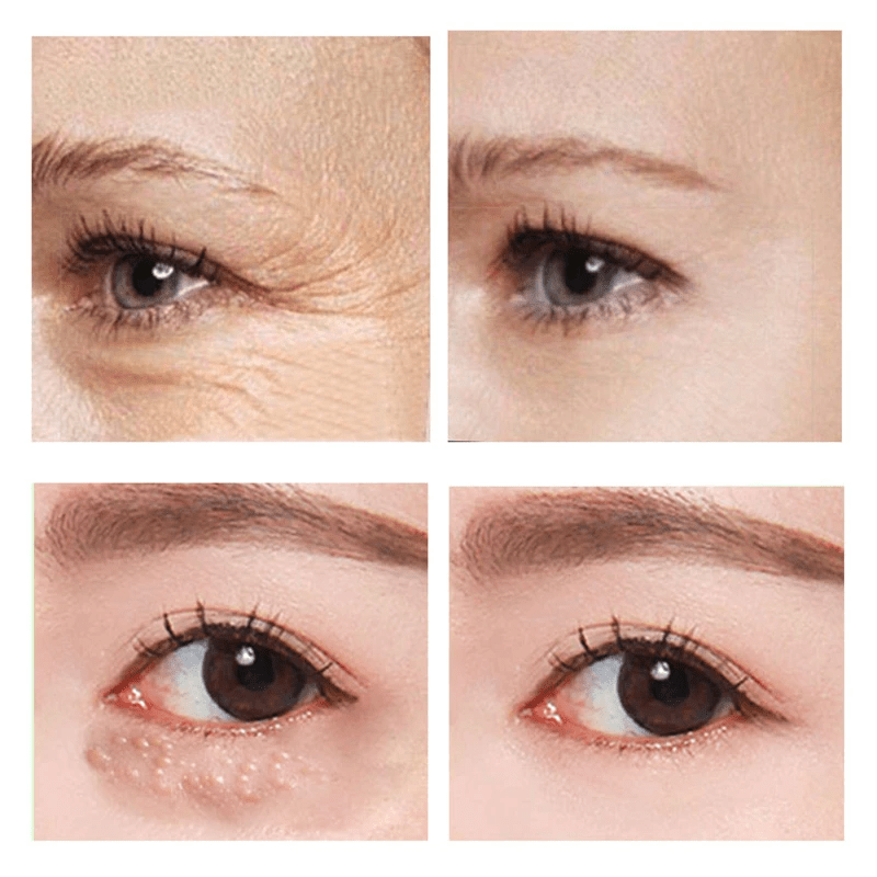 RambleaLift™ — Instantly Restore Youthful, Radiant Eyes That Stop Time