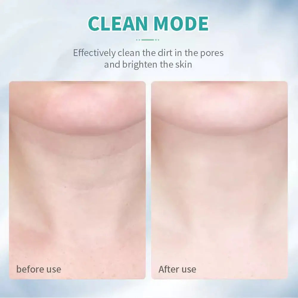 SmoothPro | Anti-Wrinkle and Facelift Face and Neck Massage Device