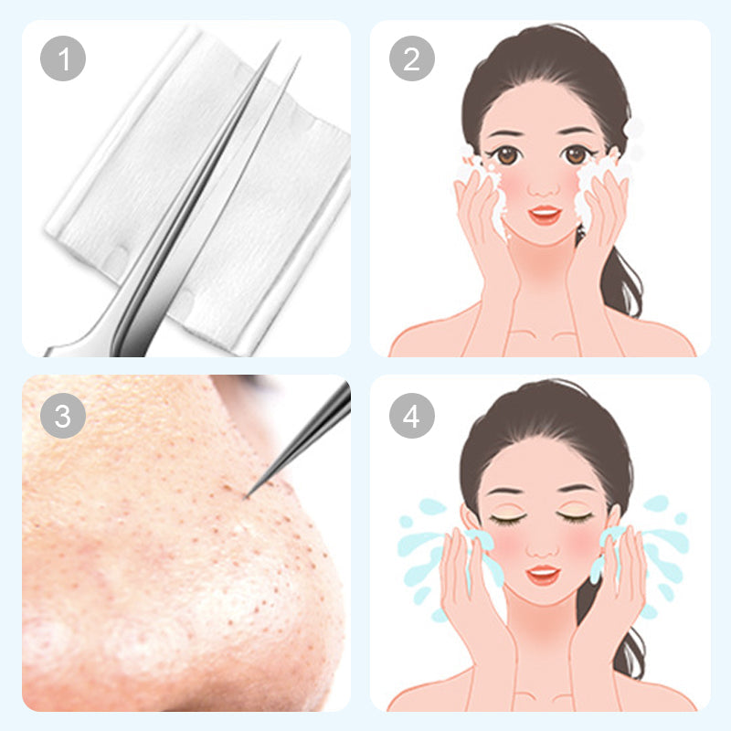 Stainless steel blackhead removal kit