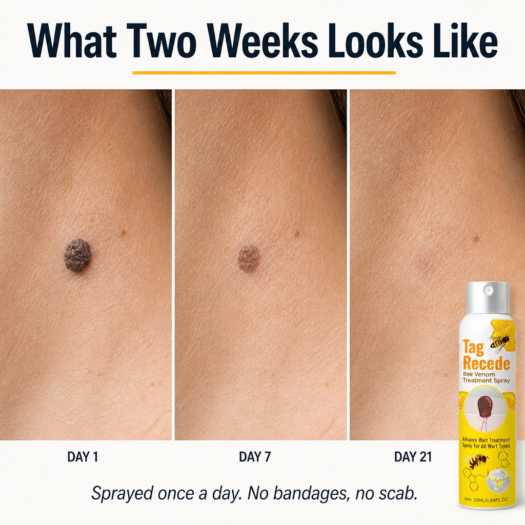 VenomaSilk™ — Spray Stubborn Warts Away Painlessly with Bee Venom and Salicylic Acid