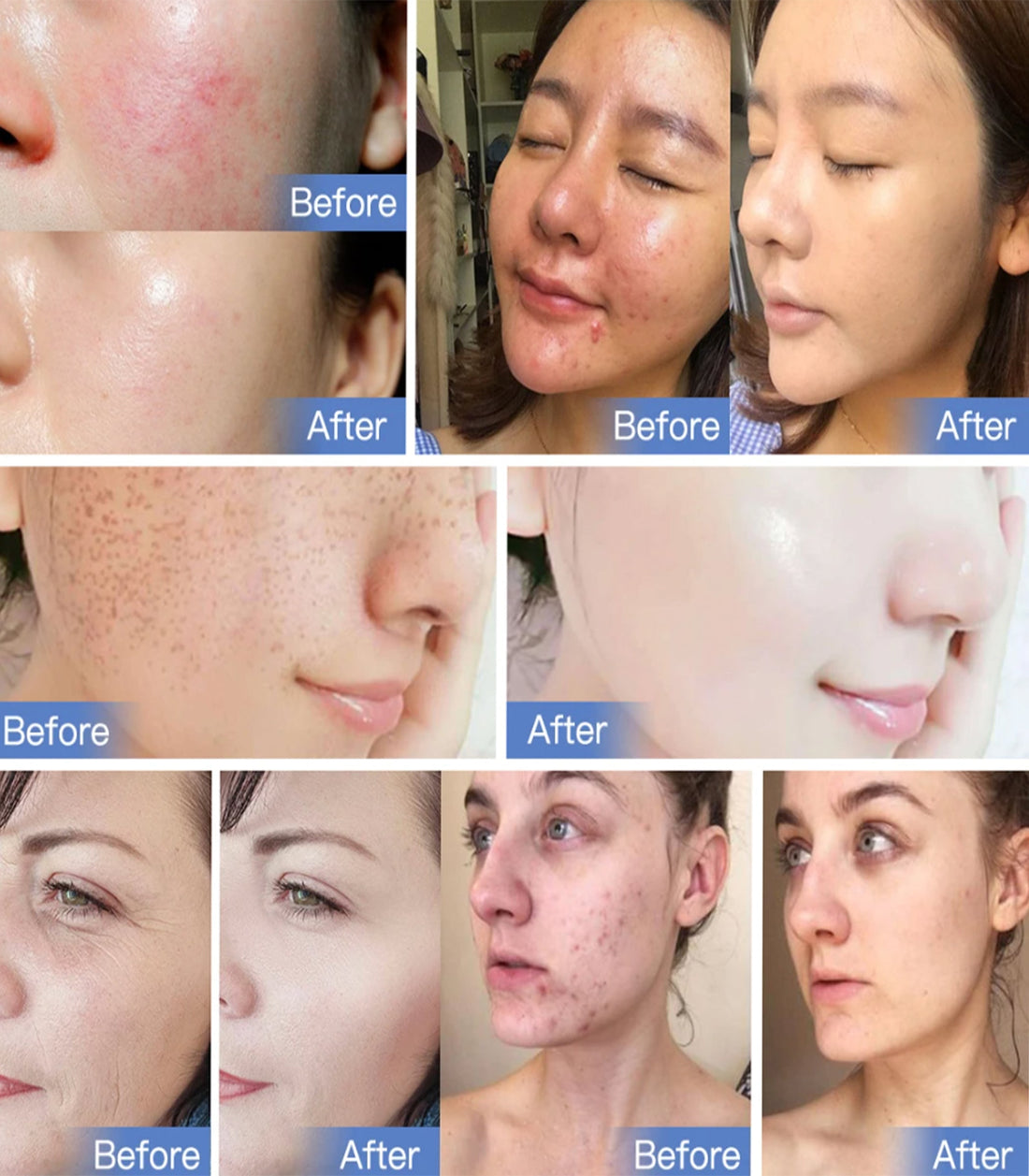 Seven-Color LED Light Therapy Device for Skin Renewal