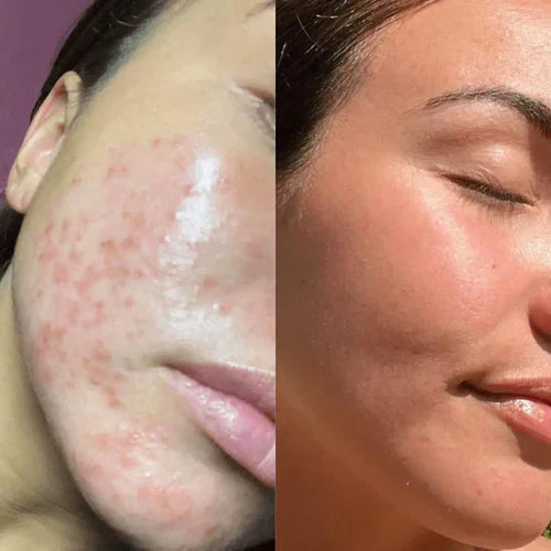 RadianceWave™ — Unlock Radiant, Youthful Skin That Turns Heads Every Time