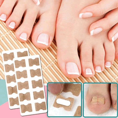 FinePatches™ | Correction Patches for Beautiful and Healthy Nails