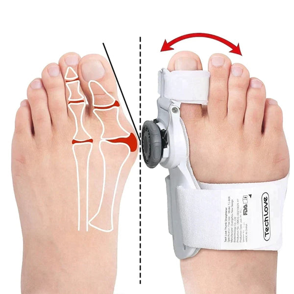 Alignix - Universal Corrector for Hallux Valgus