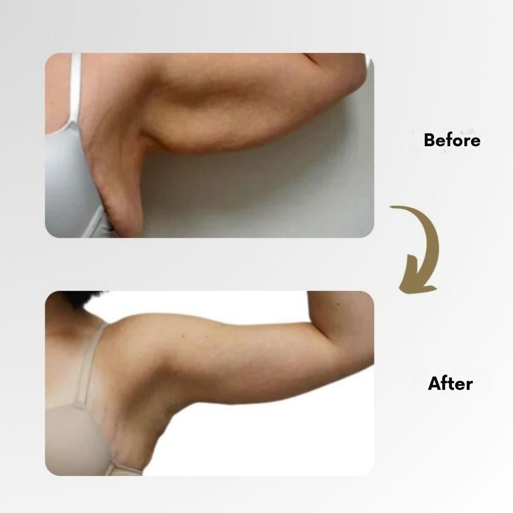 LymphMag™ Ring — Ignite Your Fat-Burning Power and Unleash Explosive Energy