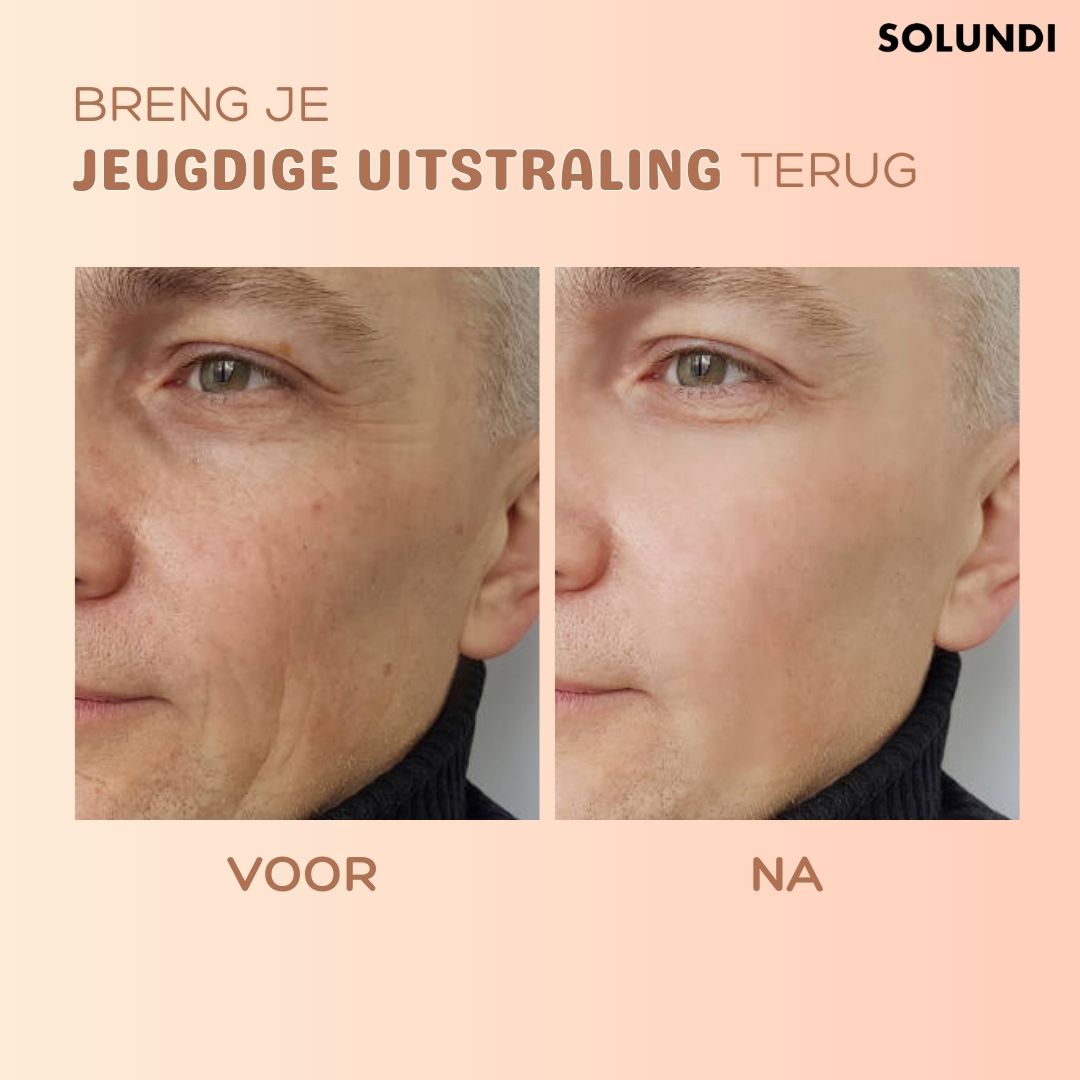 LumiDermis™ — Instantly Erase Wrinkles and Reveal Radiant, Youthful Skin