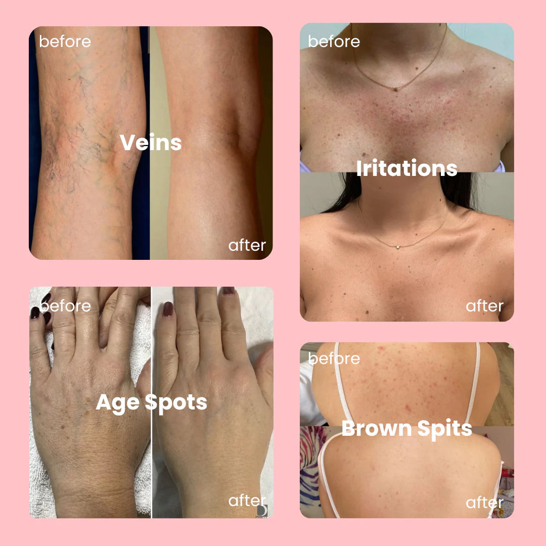 RadiantVeil™ — Instantly Reveal Smooth, Flawless Skin That Feels Like You