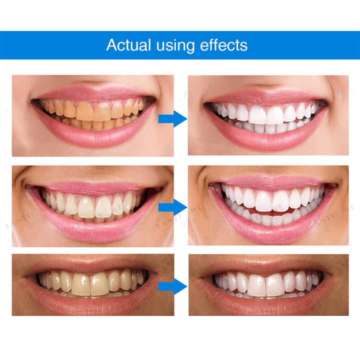 RadiantPearl™ Whitening Essence — Brighten Your Smile with Gentle, Head-Turning Confidence