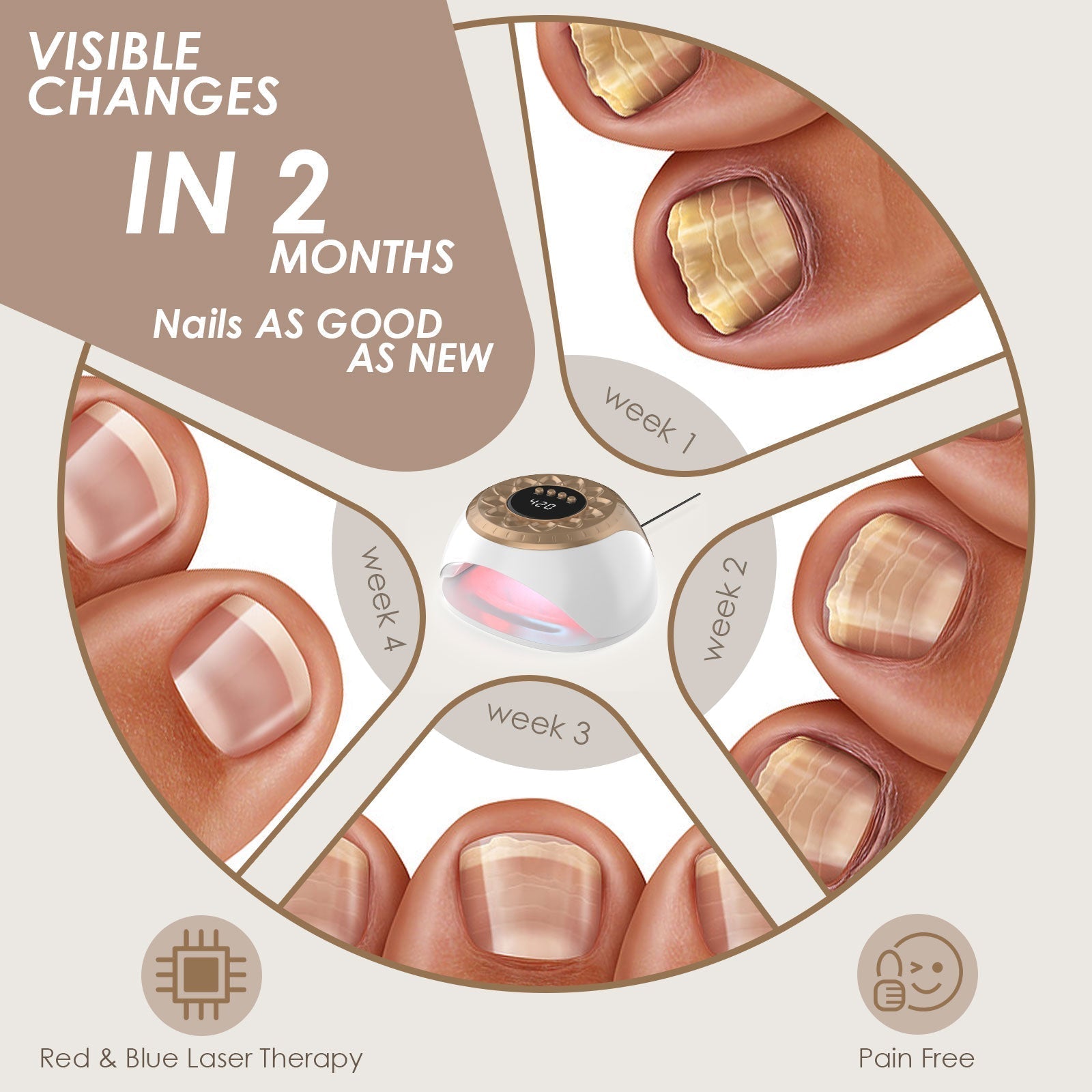 Device for Treating Toenail Fungus with Gold Light Technology